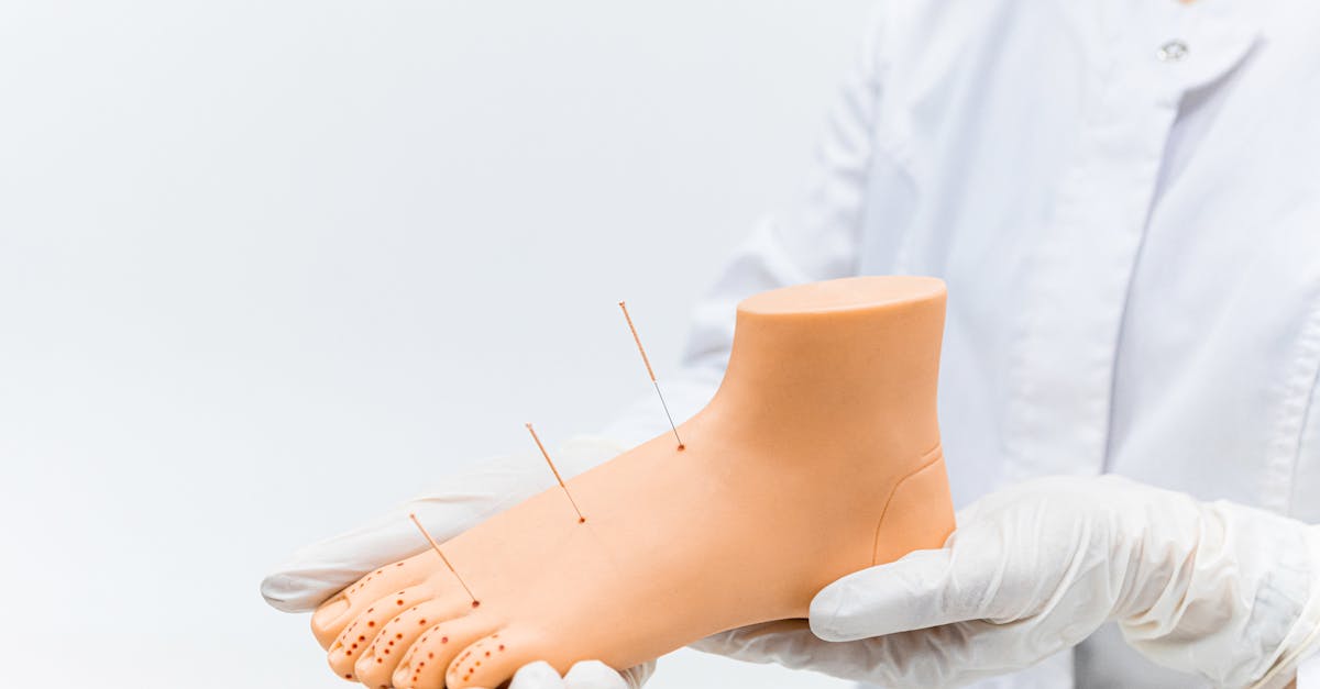 Acupuncture for Back Pain Relief: A Comprehensive Guide