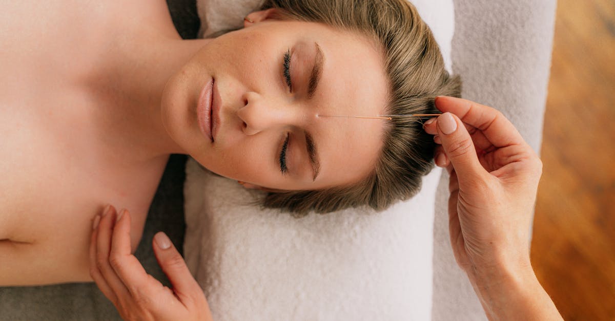 Exploring the Relationship Between Acupuncture and Sleep Improvement
