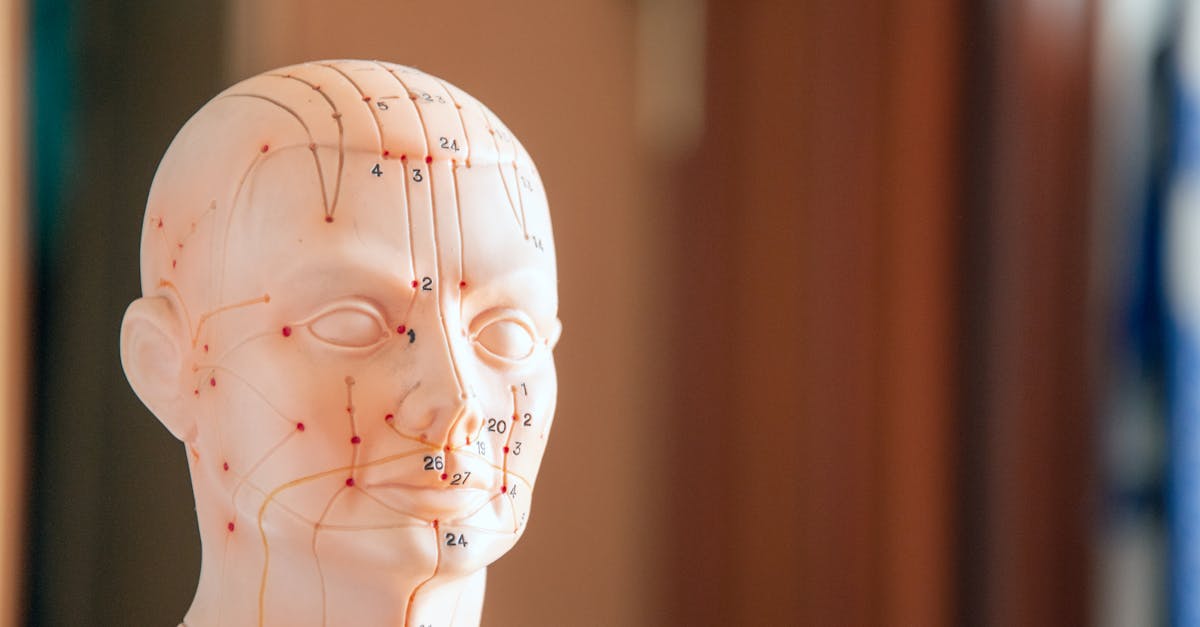 How to Navigate Insurance Coverage for Acupuncture Treatments