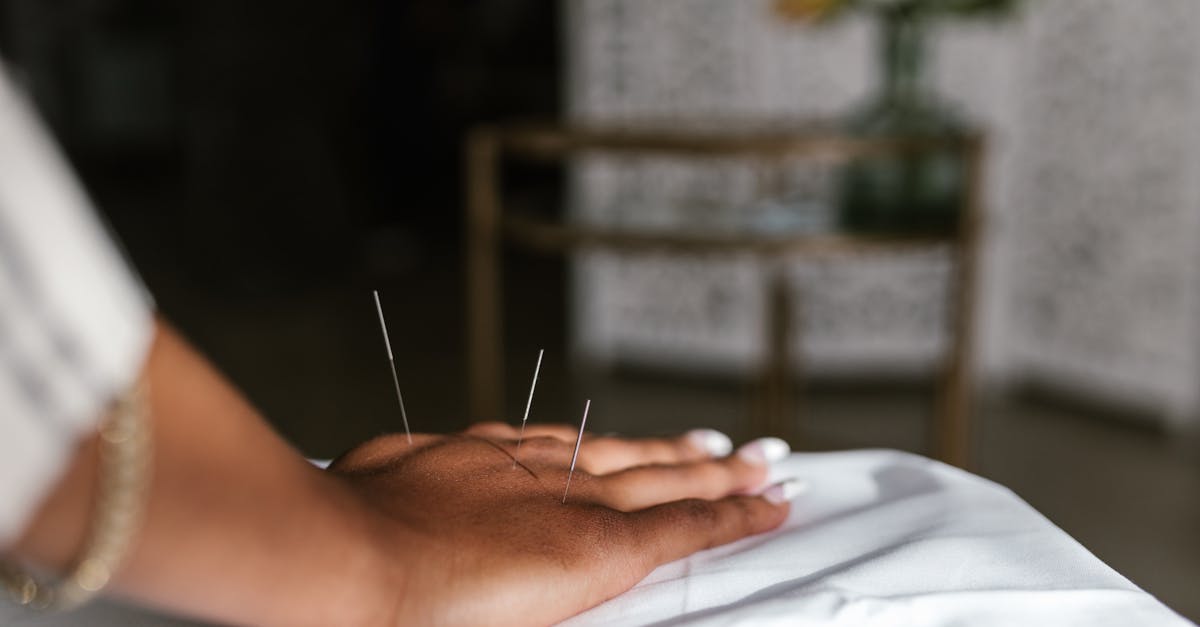 Navigating Melbourne's Acupuncture Scene: Location Insights