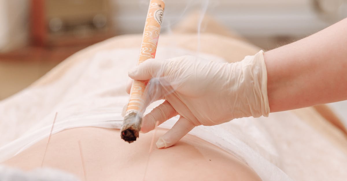 Personal Stories: Acupuncture’s Impact on Sleep for Melburnians