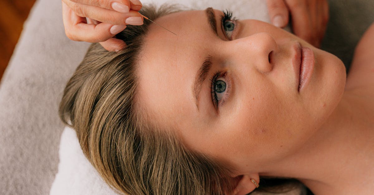 The Effectiveness of Acupuncture in Reducing Sciatica Discomfort