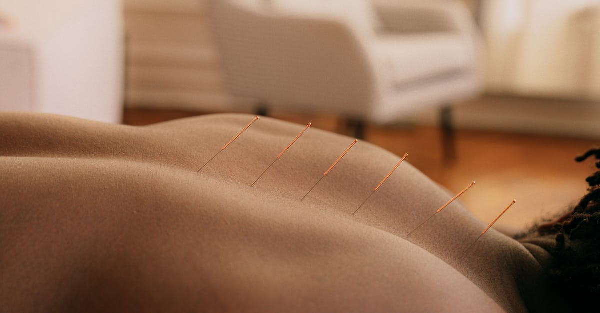The Role of Acupuncture in Combatting Fatigue